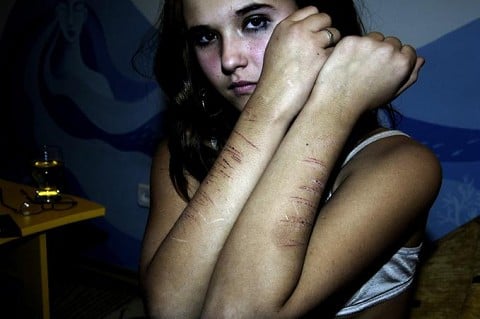Cherishing your scars