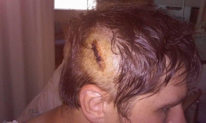 Matt Faces Death &amp; Chooses to Not Fear